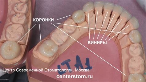 Оценка состояния коронки и проверка совместимости