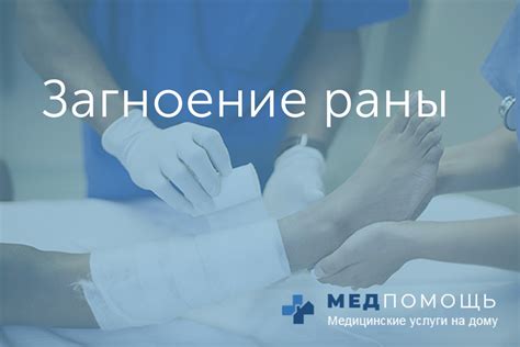 Очищение гнойной раны у ребенка перед лечением