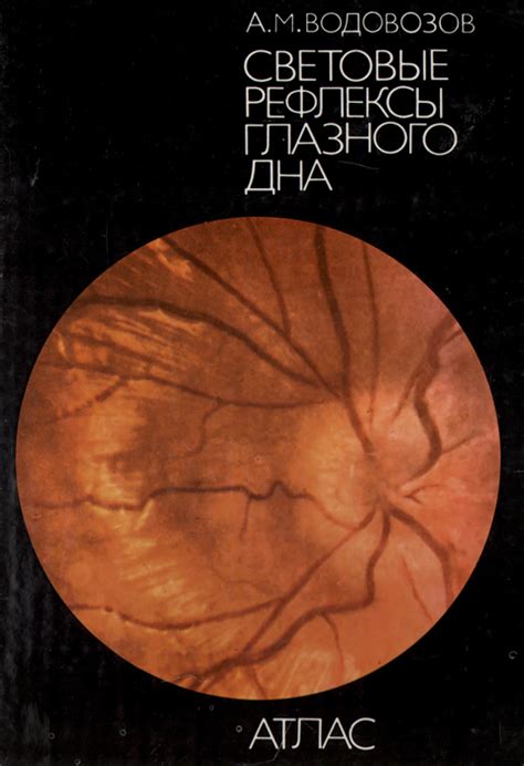 Патологии глазного дна