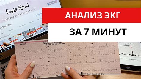 Патологические причины укорочения pq на ЭКГ