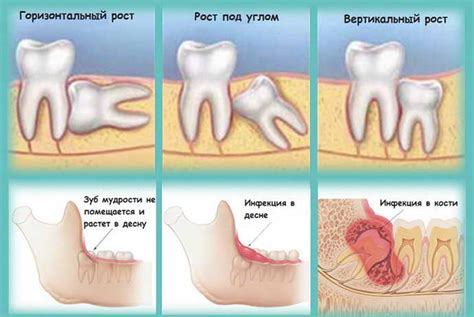 Первоначальные этапы перед удалением