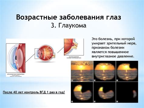 Плохая освещенность и возрастные изменения