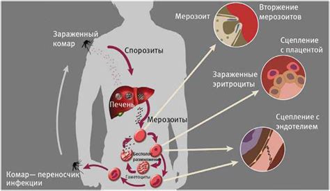 Повторная инфекция: как избежать возвращения паразитов после терапии