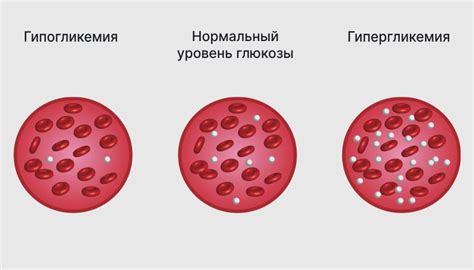 Повышенный уровень глюкозы в периферической крови: причины и последствия