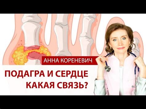 Подагра и связь с повышенным уровнем глюкозы