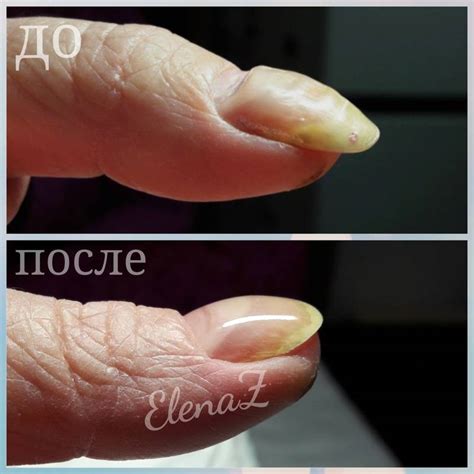Подготовка ногтей к нанесению гель-лака: основные шаги и рекомендации