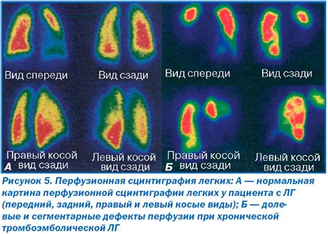 Показания для применения Глюконорма и глибомета