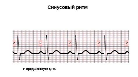 Показатели электрокардиограммы: основы понимания синусового ритма
