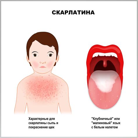 Полезные советы и рекомендации по использованию Betesda NILM