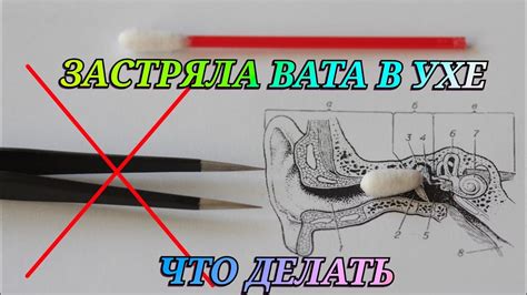 Помощь при проколотом ухе, начавшем гнить