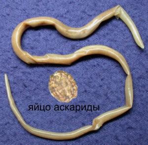 Понятие глистов и их распространение