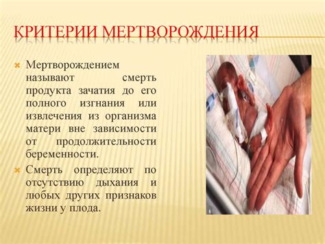 Понятие мертворождения: определение и статистика