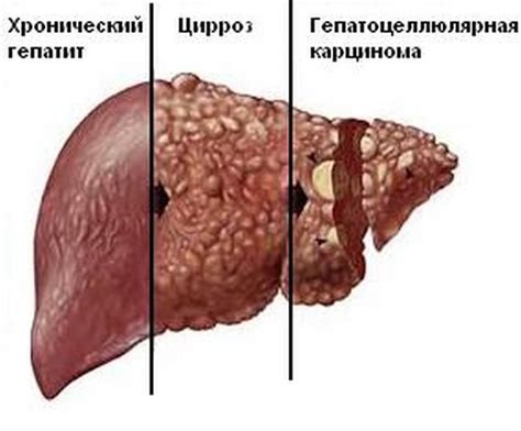 Постоянное употребление алкоголя и его воздействие на функционирование печени и почек