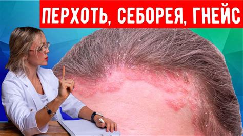 Почему возникает запах жира на голове