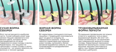 Почему возникает перхоть на коже пальцев: главные причины и факторы