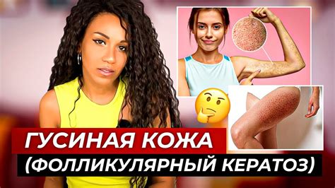 Почему гусиная кожа - полезный источник железа