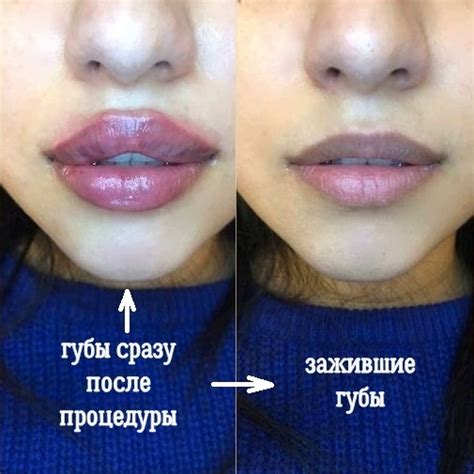 Почему нижняя губа на лице вызывает зуд: причины и возможные решения