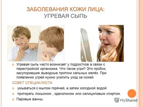 Правила поддержания гигиены и ухода за кожей при проявлении потницы на лице малыша
