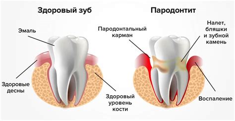 Практические рекомендации по уходу за тканями пародонта после процедур восстановления