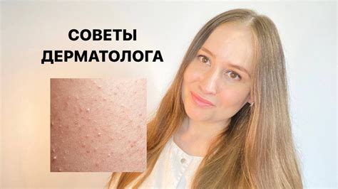 Предосторожности и меры предотвращения проблем с кожей на руках