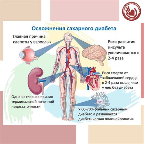Предположение о наличии осложнений при сахарном диабете 2 типа