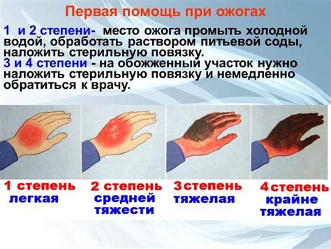 Предупреждение осложнений при ожоге кипятком у ребенка
