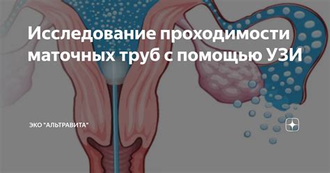 Преимущества и недостатки УЗИ маточных труб