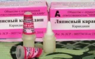Преимущества и недостатки азотного удаления наростов