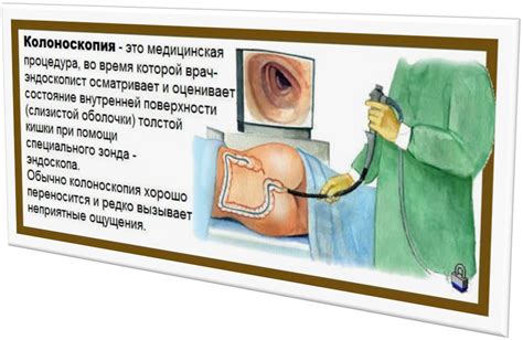 Преимущества эффективного препарата для процедуры колоноскопии