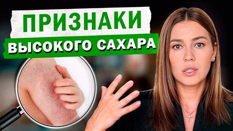 Признаки повышенного уровня глюкозы в крови