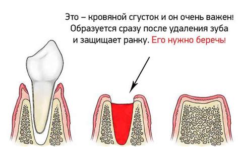 Применение отвара ромашки для успокоения десен после удаления зуба