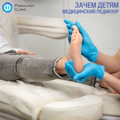 Применение препаратов для лечения натоптышей