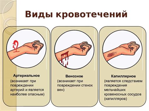 Применение различных подходов и методов для остановки кровотечения