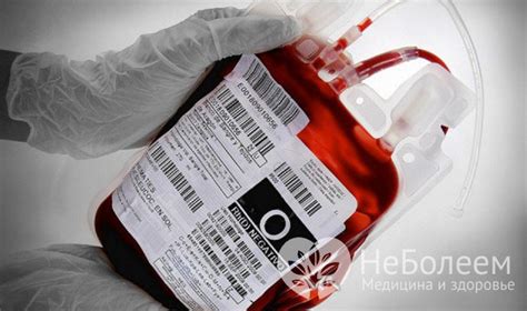 Принципы терапии гемолитической анемии и выбор методов лечения