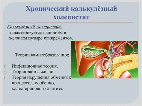Присутствие конкрементов в желчном органе
