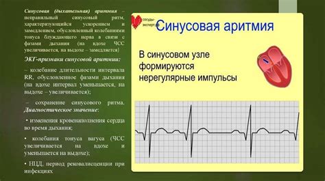 Причины возникновения отклонения на ЭКГ у маленького пациента