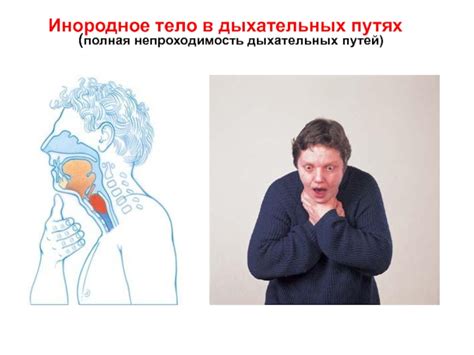 Причины возникновения преград в дыхательных путях у детей