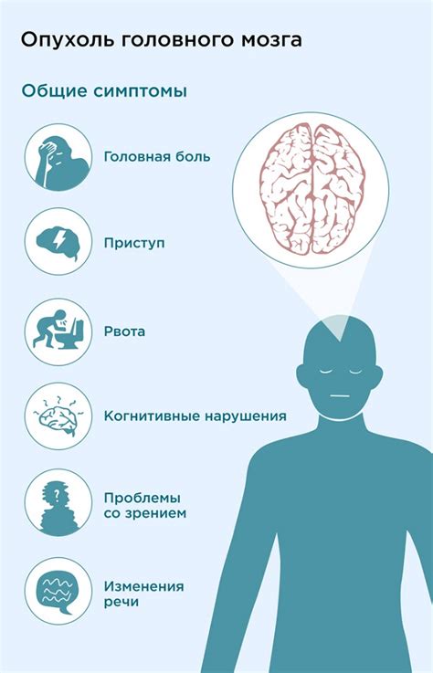 Причины возникновения состояния "голова как тяжелая"