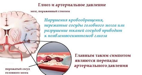 Причины глиоза в лобной части мозга