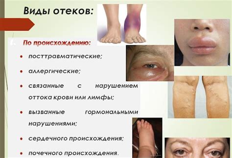 Причины глюков у пожилых людей