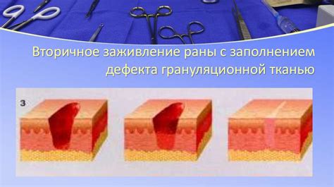 Причины замедленного заживления раны на нижней конечности