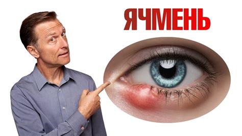 Причины зуда и гноения в глазу: лечение и рекомендации