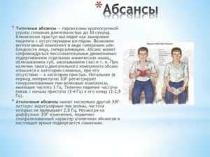 Причины и проявления абсансов у детей с эпилепсией