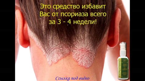 Причины и симптомы появления высыпаний на волосистой части тела