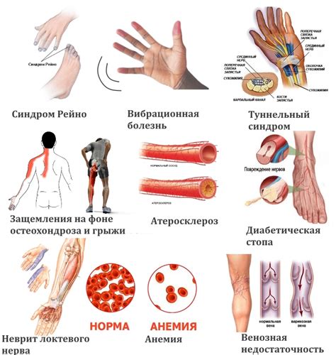 Причины и эффективные методы преодоления онемения верхних конечностей