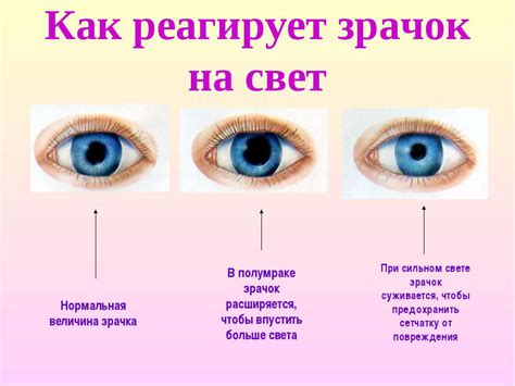 Причины нарушений отклика зрачков на освещение
