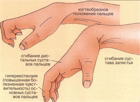 Причины неприятного ощущения на пальцах правой руки