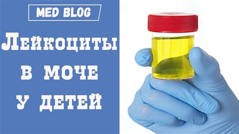 Причины отрицательного наличия порфиринов в моче у взрослых