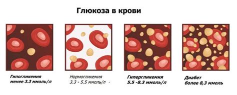 Причины повышенного уровня глюкозы в плазме у мужчин