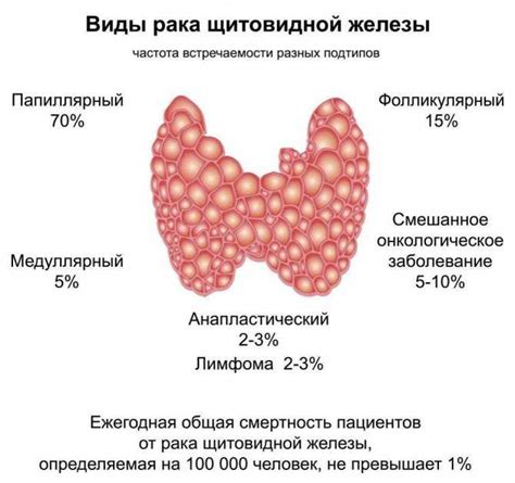 Причины разрастания щитовидной железы
